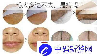 毛太多进不去