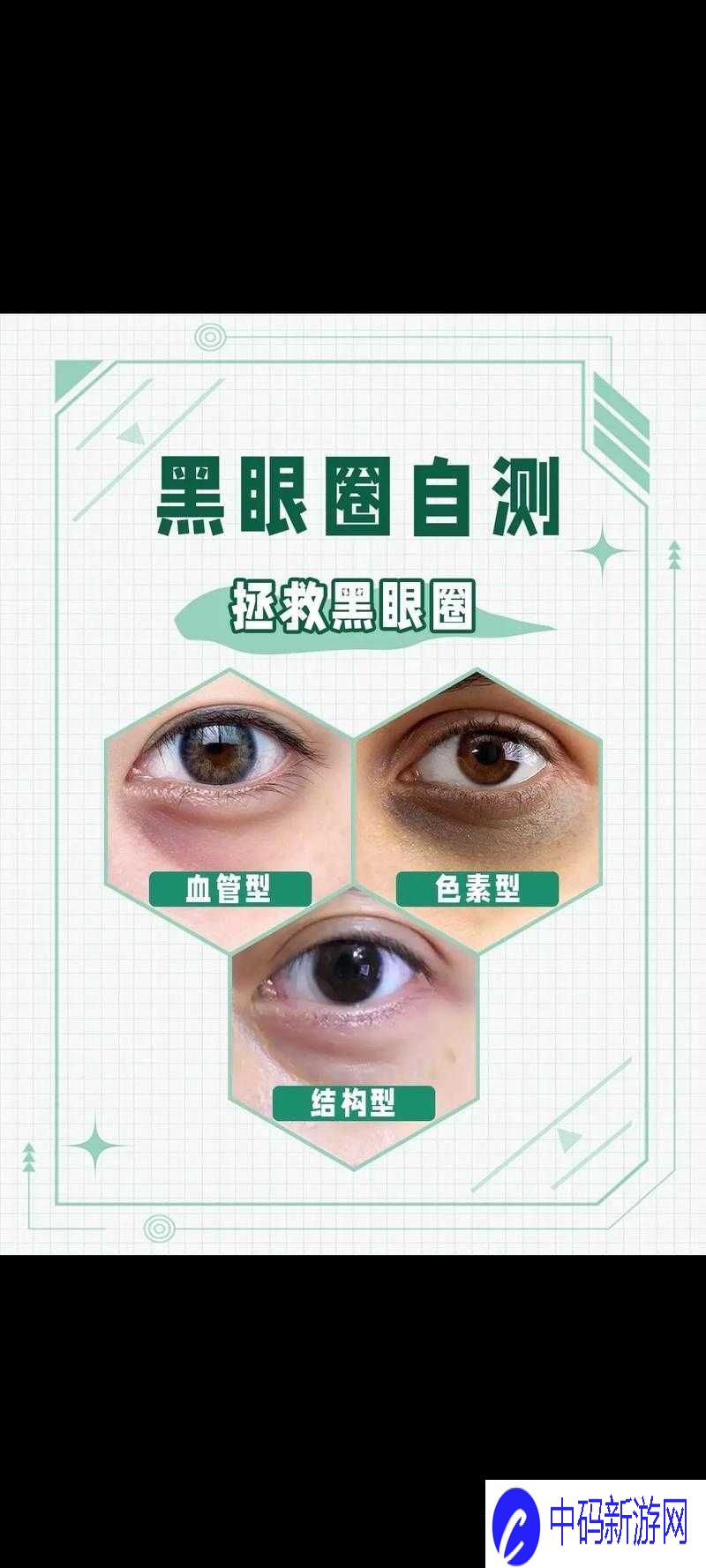 测试黑眼圈类型