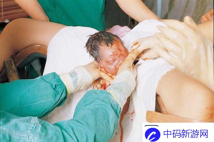 胎头湿漉漉挤出