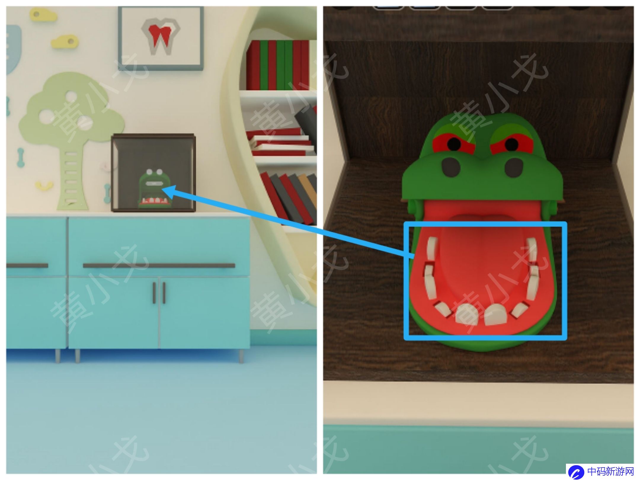 Escape Room：Dental（密室逃脱：牙科诊所）攻略（一）