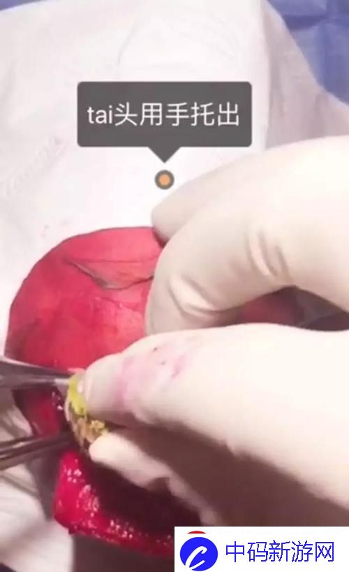 考场夹胎头